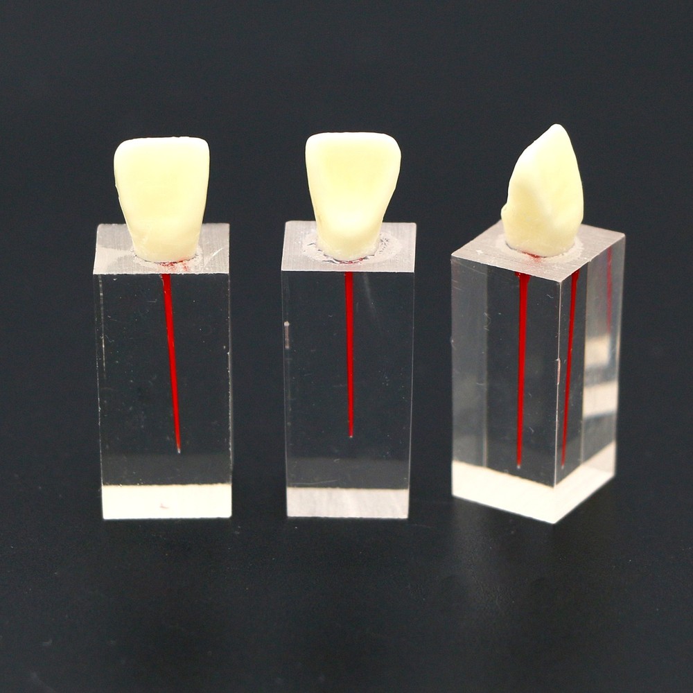 5Pcs Dental Root Canal Teeth molar Model Study Practice For Endodontic Pulp File