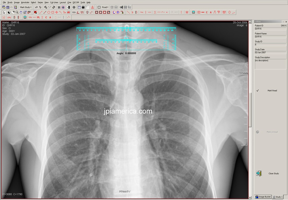 PACS radiology software