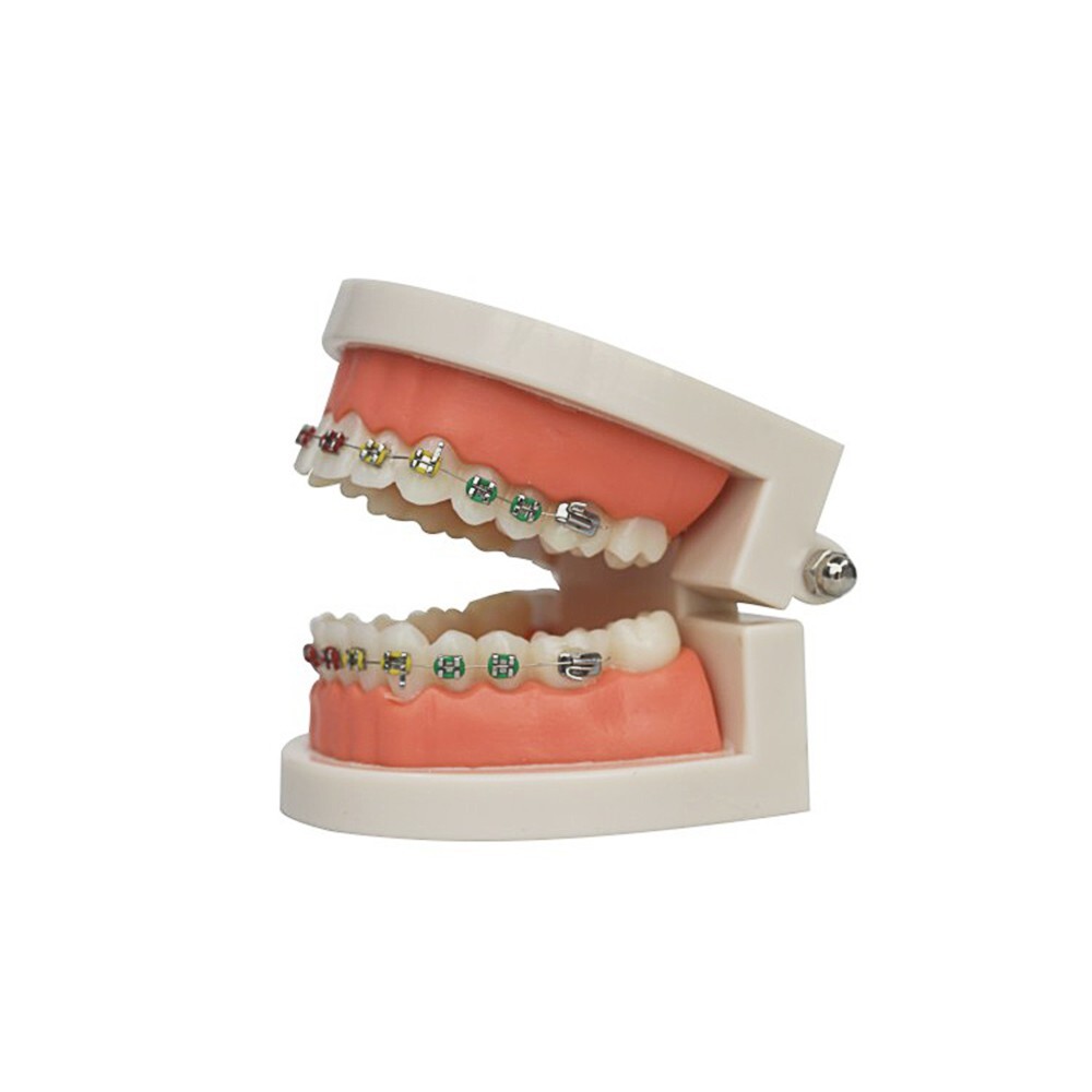 Dental Typodont Orthodontic Treatment Teeth Model Malocclusion Study w/ Bracket