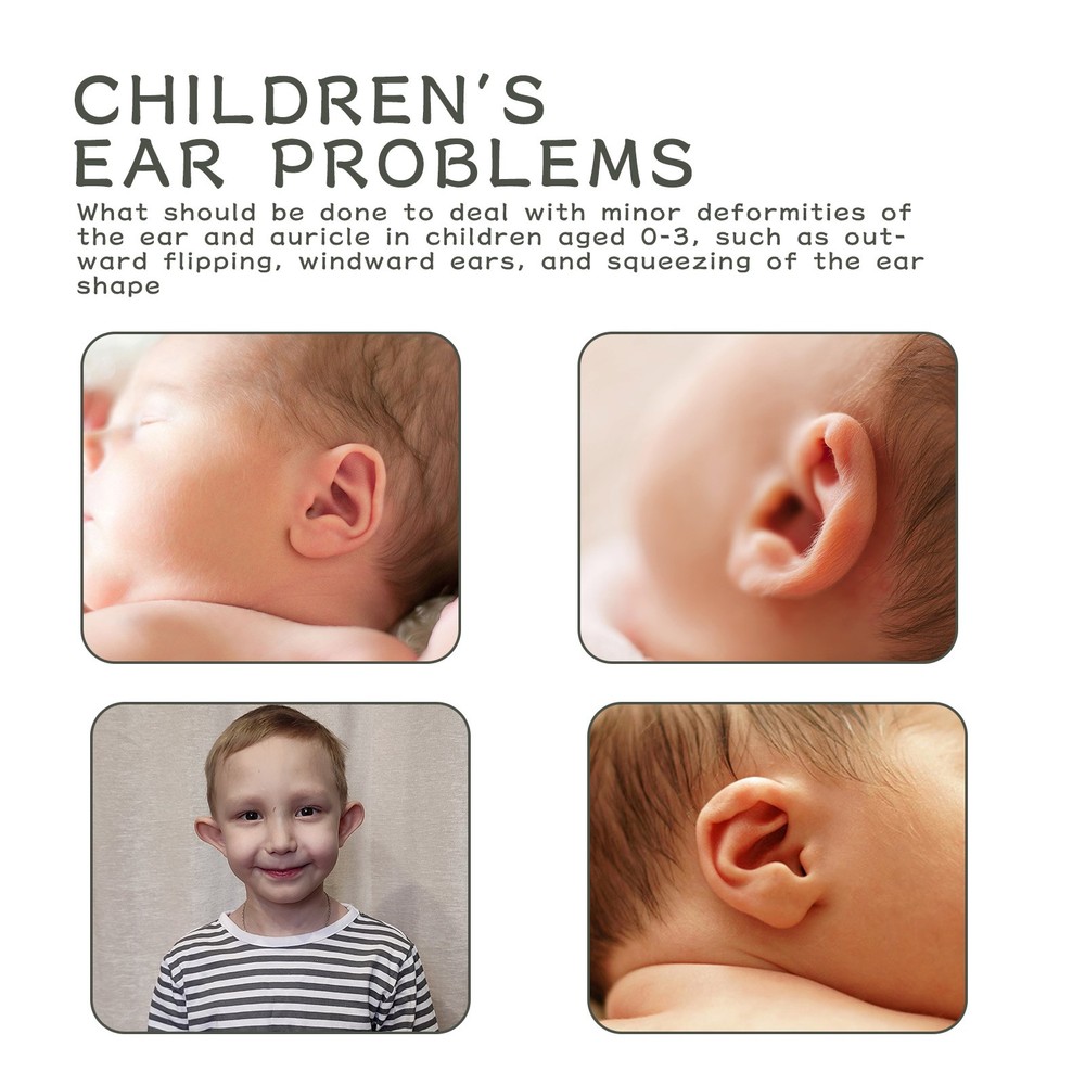 Silicone Ear Correction Patch for Babies Children Protruding Ear Shaping