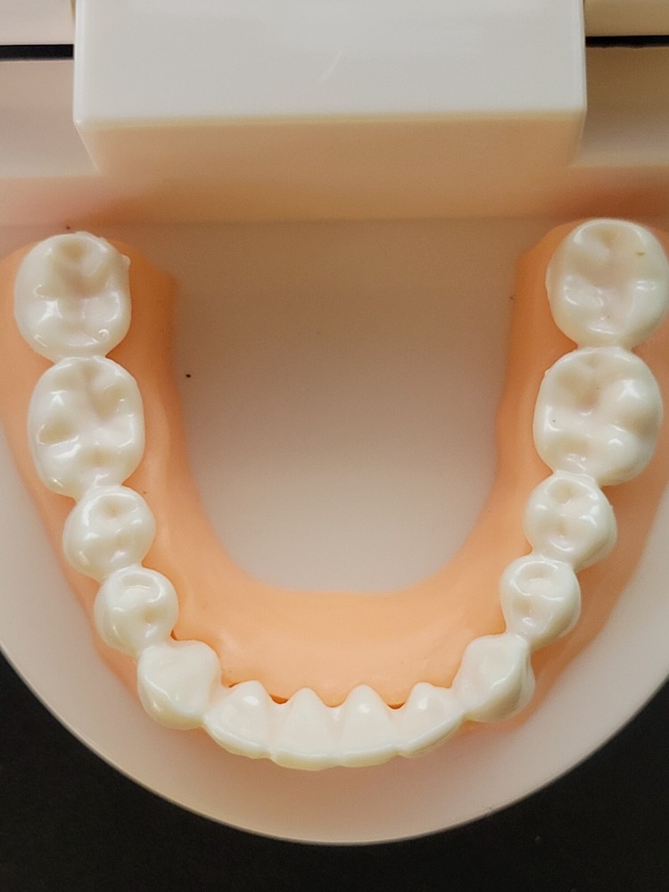 Dental Typodont Study Model - Fixed Teeth