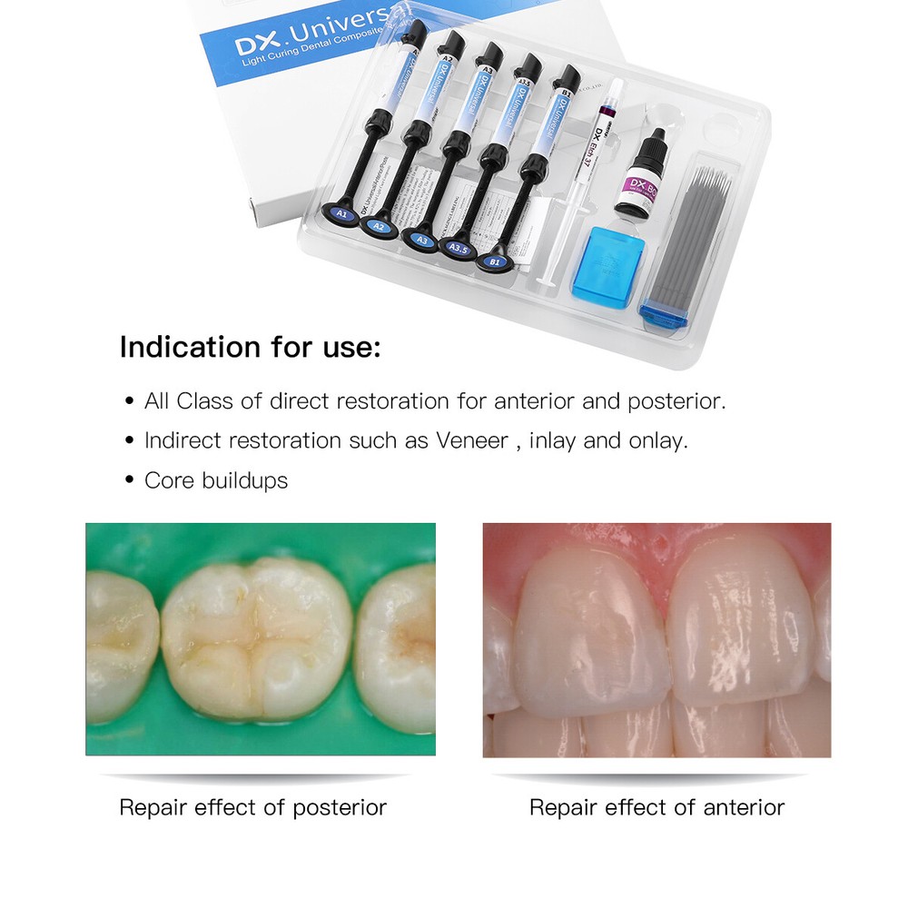 Dental Light Cure Composite Resin Etching Adhesive Kit/ LED Curing Light Lamp US