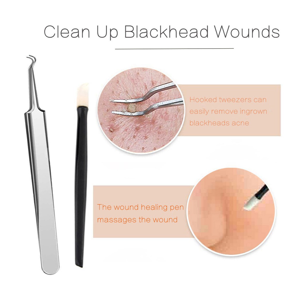 Face Cleansing Acne Beauty Tool Kit Blackhead Extractor 9 Pack
