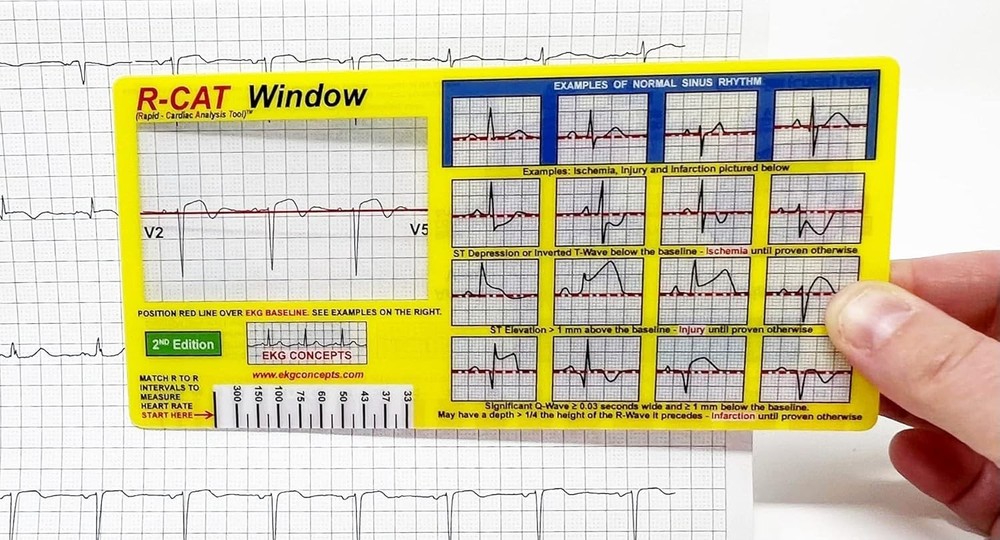 EKG Window 2nd Edition