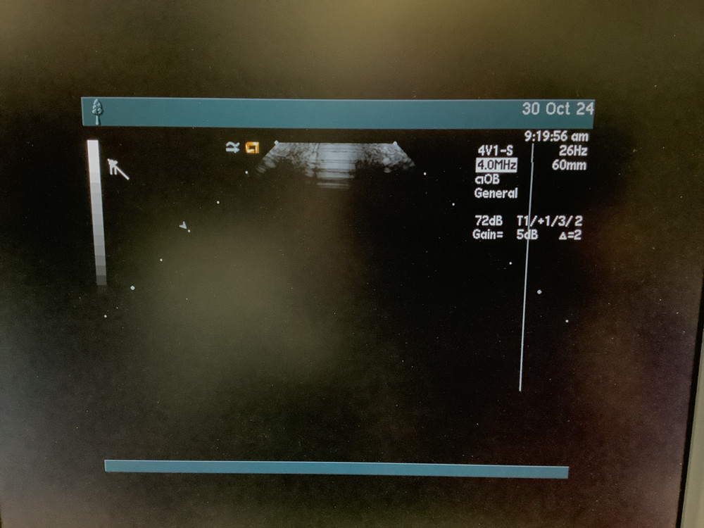 2017 Acuson 4V1 for Sequoia Linear Array Ultrasound Probe