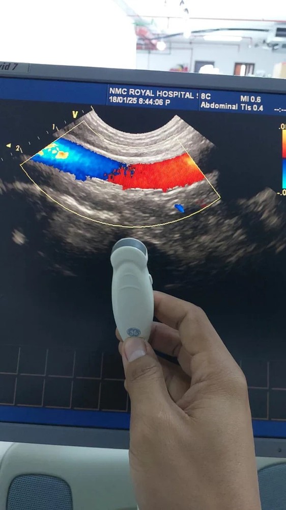 GE 8C micro convex array ultrasound transducer. Checked dxb