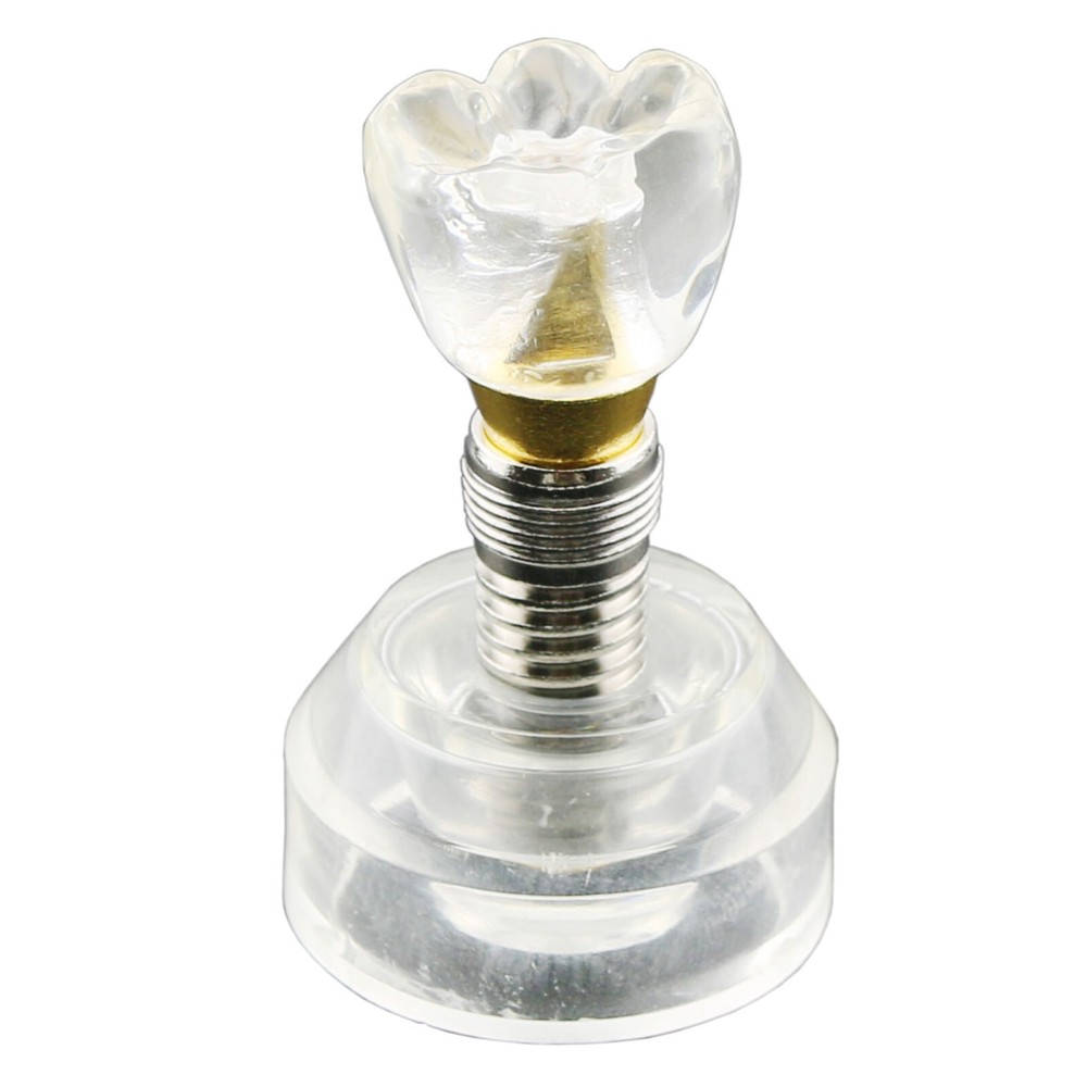 Dental Implant DemonstrationTeeth Study Teach Crown Model Acrylic Teeth Study