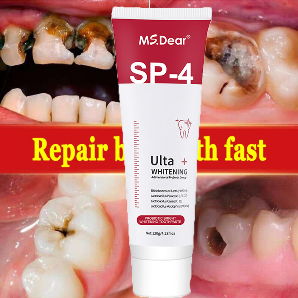 Sip-4 Toothpaste, Whitening Sp-4 Toothpaste, Sp-4 Probiotic Whitening Toothpaste