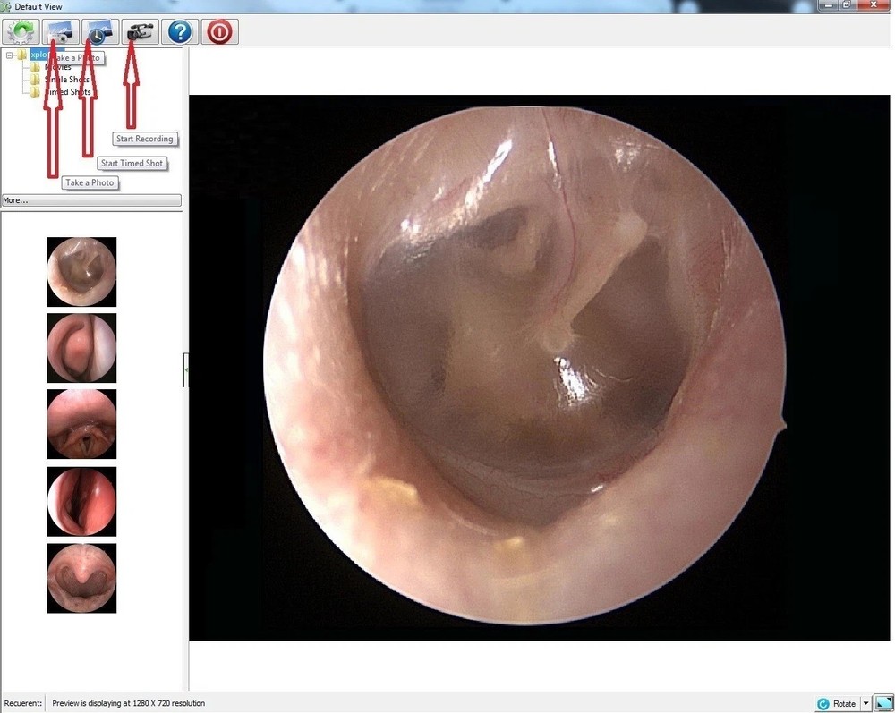Rigid Endoscope Endoscopy for Stryker HD USB Camera+Coupler+Light Source+Mount