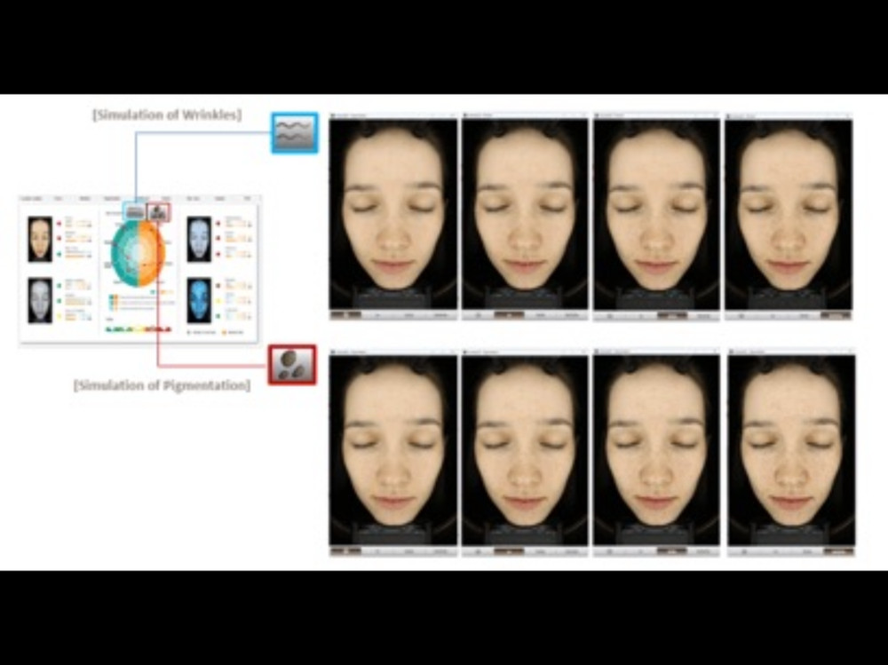 GLIMPSE – PROFESSIONAL SKIN ANALYZER 2024