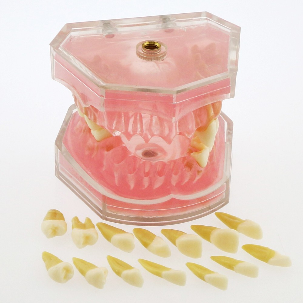 Dental Typodont Practice Model 28Pcs Removable Teeth Model Soft Gum with Cheek