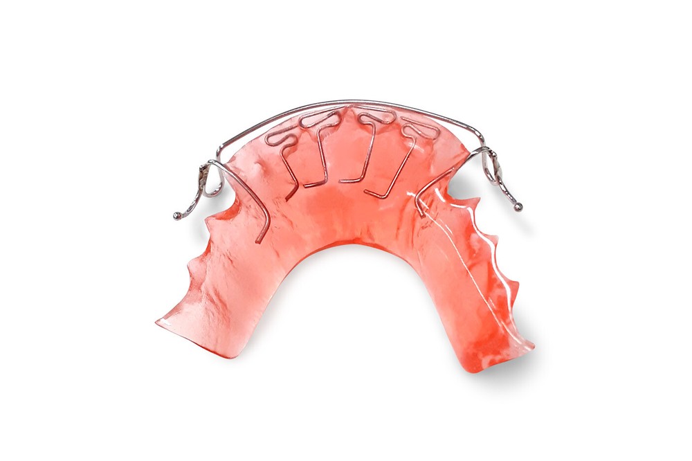 Custom Hawley Spring Retainer and Aligner, Removable, At-Home Dental