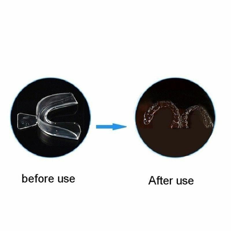 Orthodontic Retainer Fixed Corrector Teeth Retainers Thermoforming 2 Pairs Clear