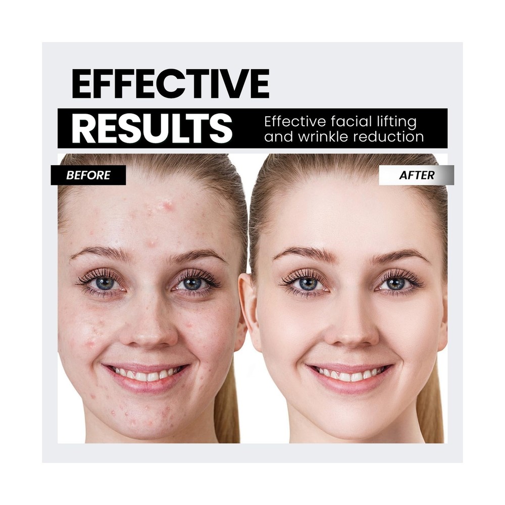 Microcurrent Facial Device,Latest Red Light Technology，Enhances The... Fa