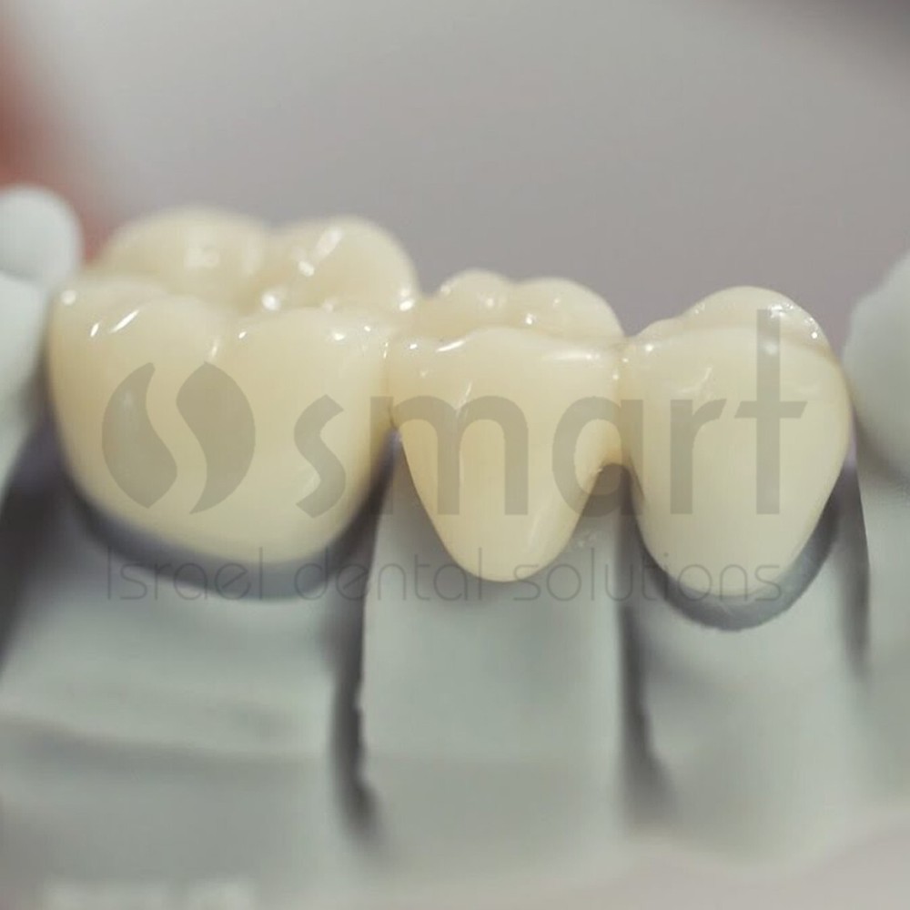 Detax Freeprint Crown 3D Printing permanent teeth 0.5L Long term bridge A3