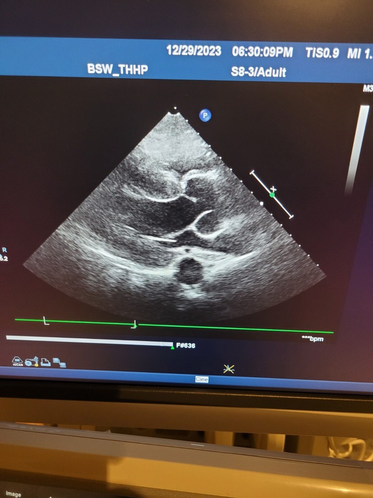 Philips S8-3 Ultrasound Ultrasound probe