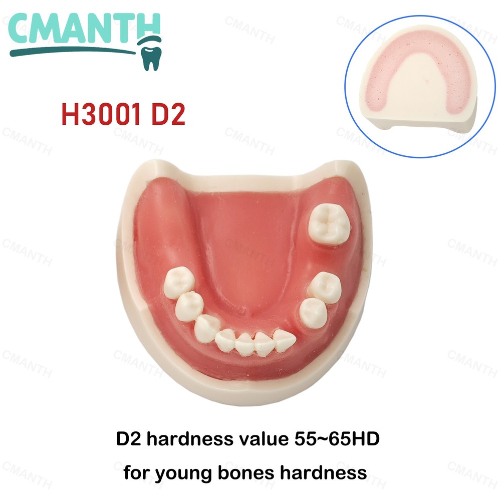 US Dental Implant Model Soft Gums Model Drilling Training Open Suture Practice