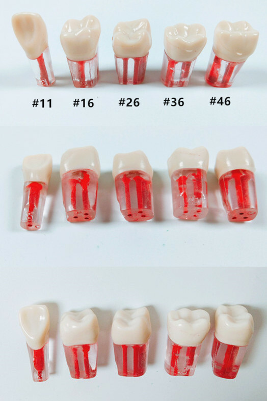 10Pcs Dental Root Canal Study Practice Model Red Pulp Files Molar Anterior Crown
