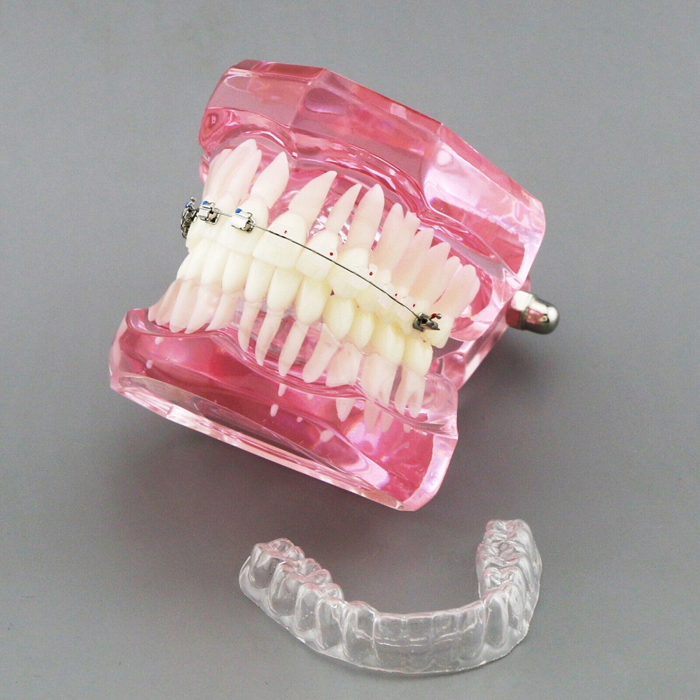Dental Typodont Model Self-ligating Metal Bracket Ceramic Transparent Retainer