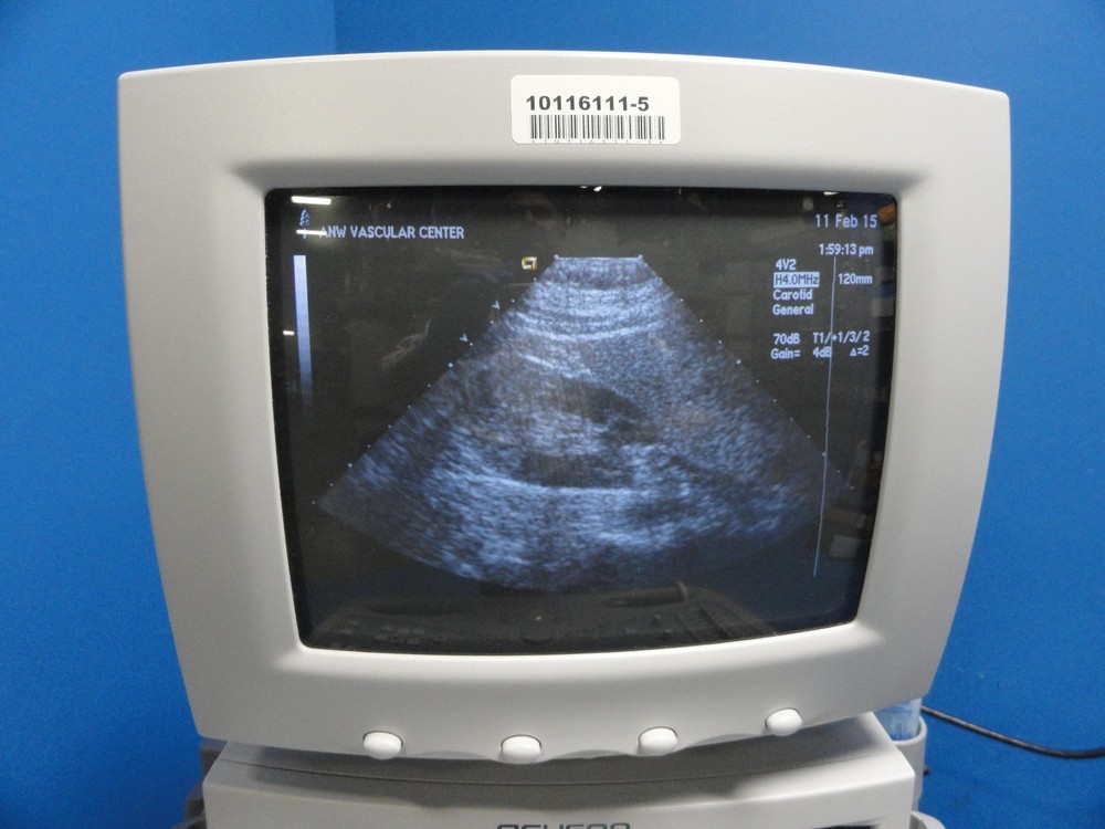 Siemens Acuson 4V2 Vector Array Ultrasound Probe – For Sequoia Series ~ 8584