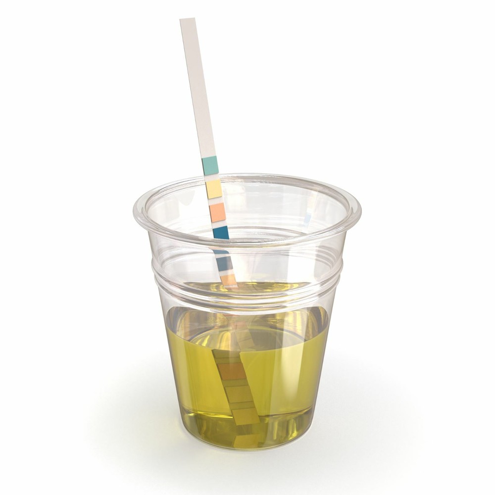 Urine Test Strips for Urinalysis 11 Parameters. 150 Cnt Urinalysis Test Strips