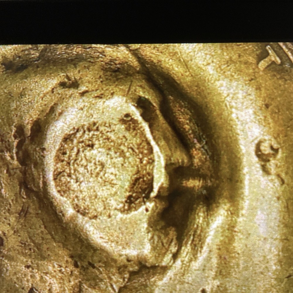 1921 Lincoln Wheat Penny. Multiple Errors On The Obv & Rev . See Pics