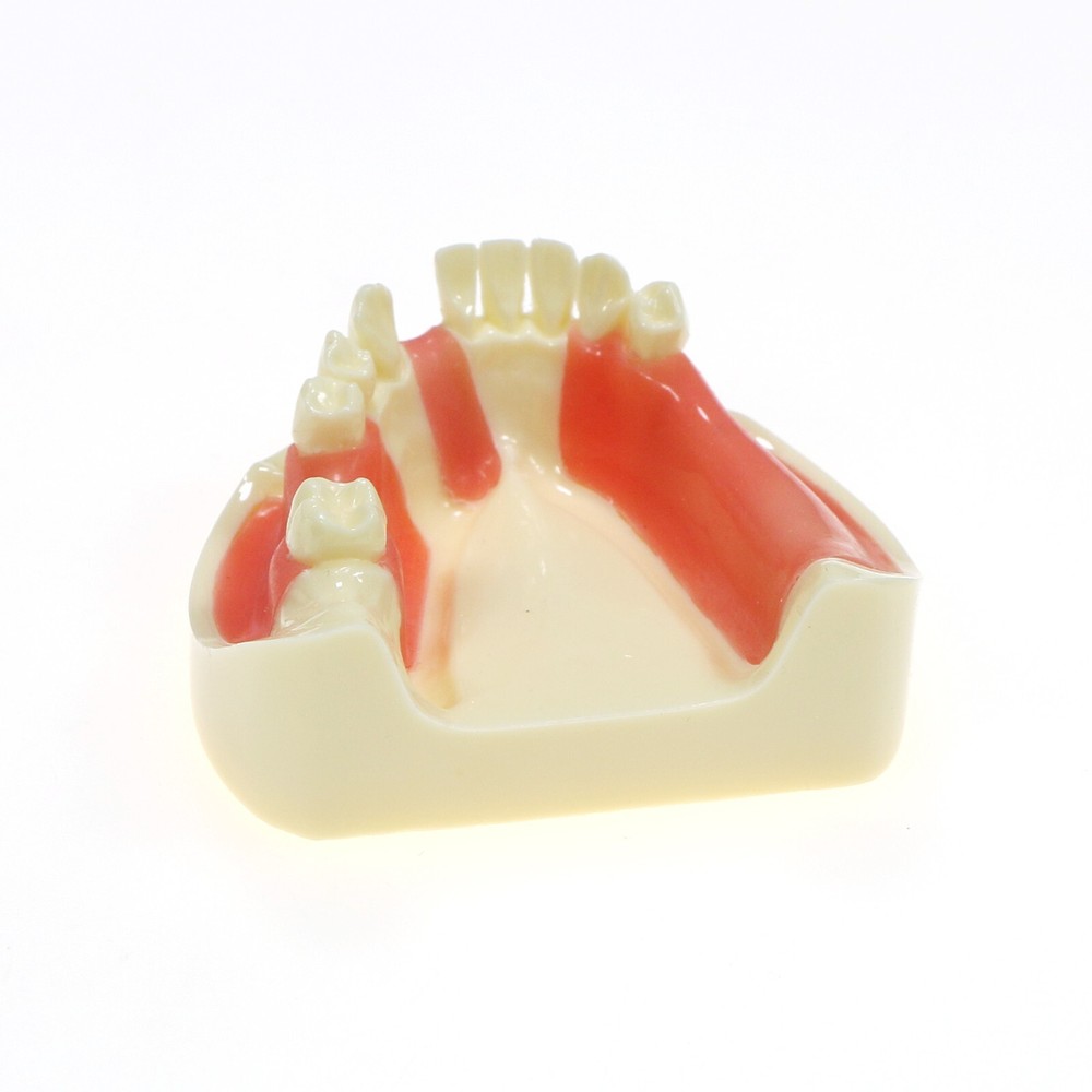 Dental Implant Practice Typodont Lower Jaw Teeth Model Removable Gingiva M2004