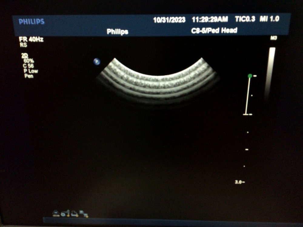 Philips C8-5 for iU22/IE33 Micro-Convex Array Ultrasound Probe