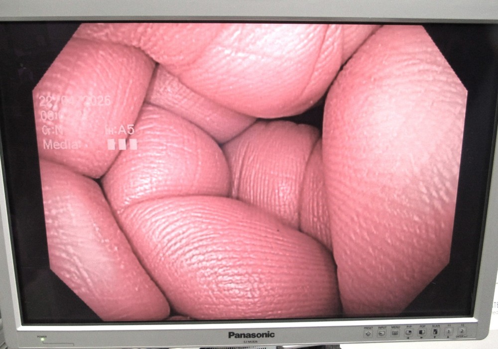 CF-H180AL Colonoscope Endoscope CFH180AL