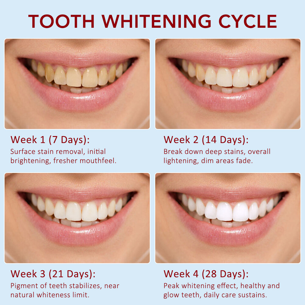 US SP-6 Probiotic Toothpaste,Sp-6 Toothpaste Whitening Quick White Toothpaste