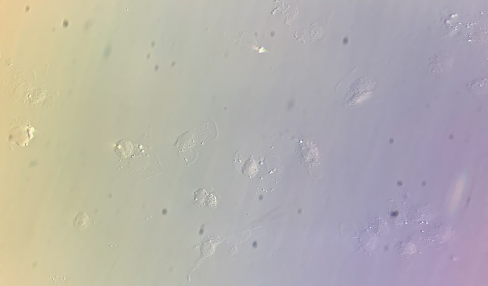 Nikon TE2000-S IVF Microscope Hoffman Modulation In Vitro with 4 Objectives