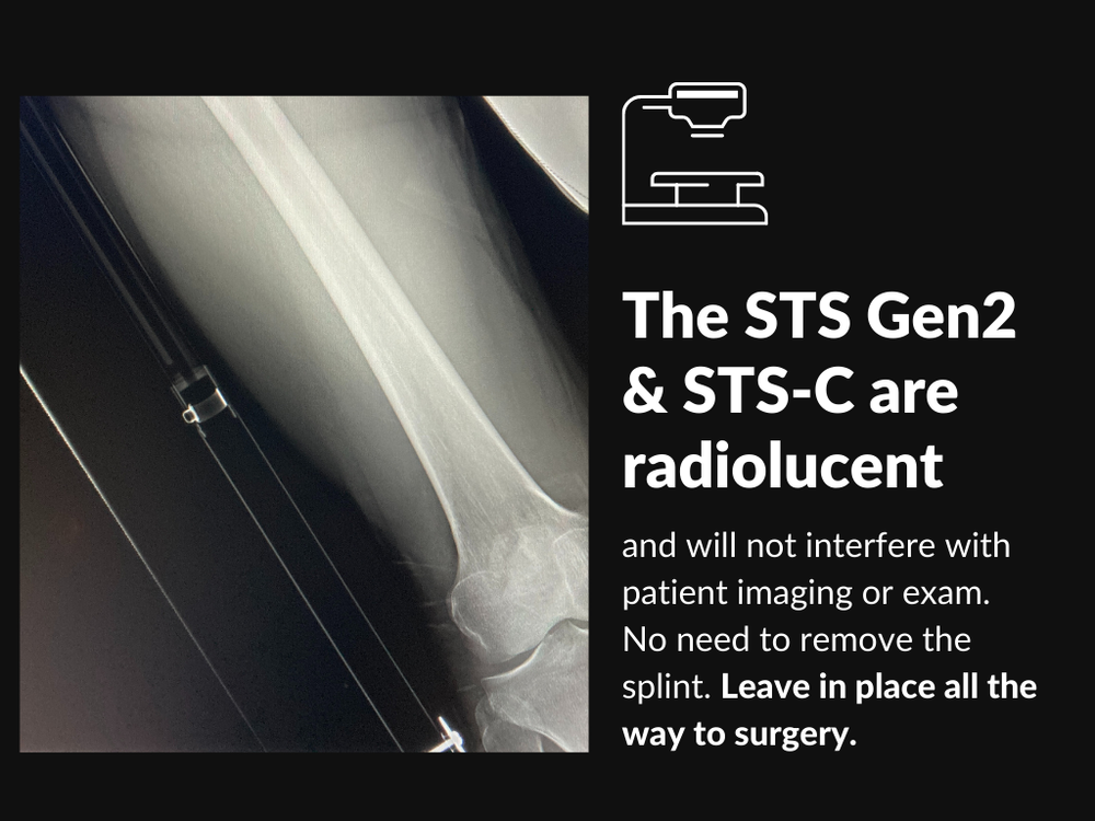 Slishman Traction Splint (STS) - Gen 2