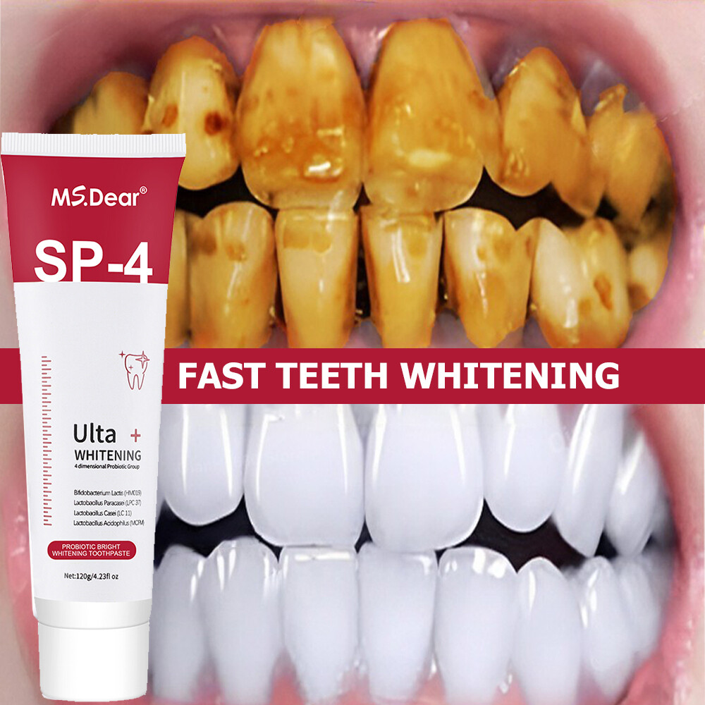 Sip-4 Toothpaste, Whitening Sp-4 Toothpaste, Sp-4 Probiotic Whitening Toothpaste