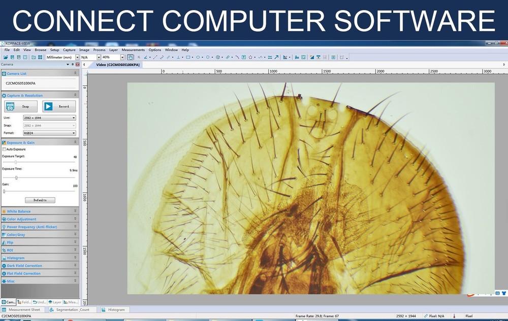KOPPACE 40X-2500X Electron Biological Microscope 5 Million Pixels USB2.0 Camera