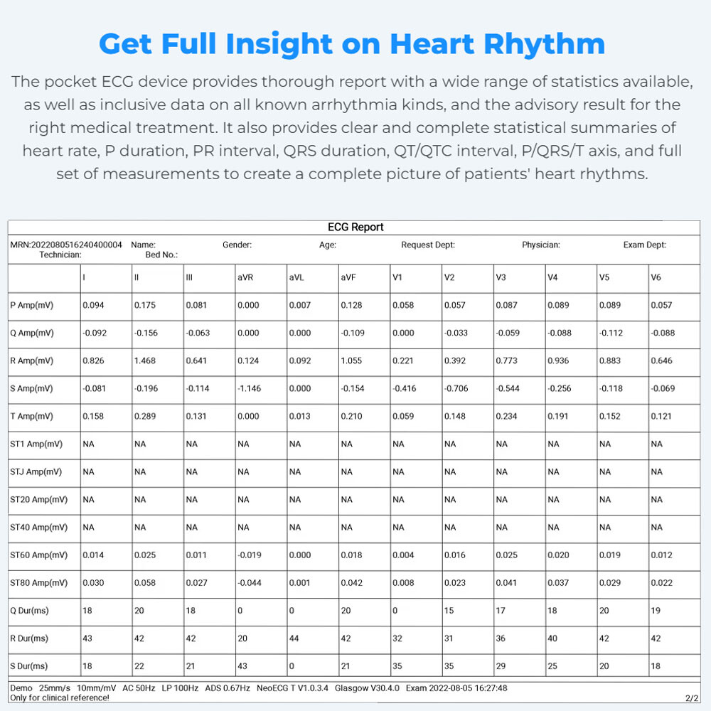 12-Lead ECG Machine Diagnostic Automatic Interpretation data transfer via email