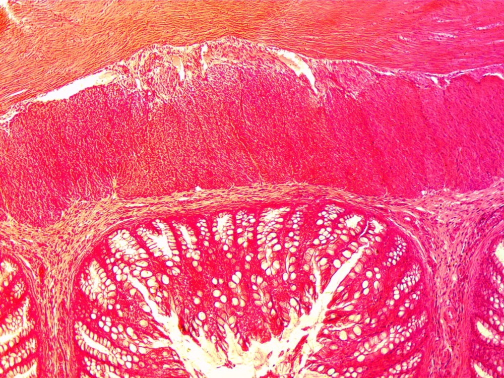 *Sale* Reconditioned AO Compound Microscope, 100X, 430X!