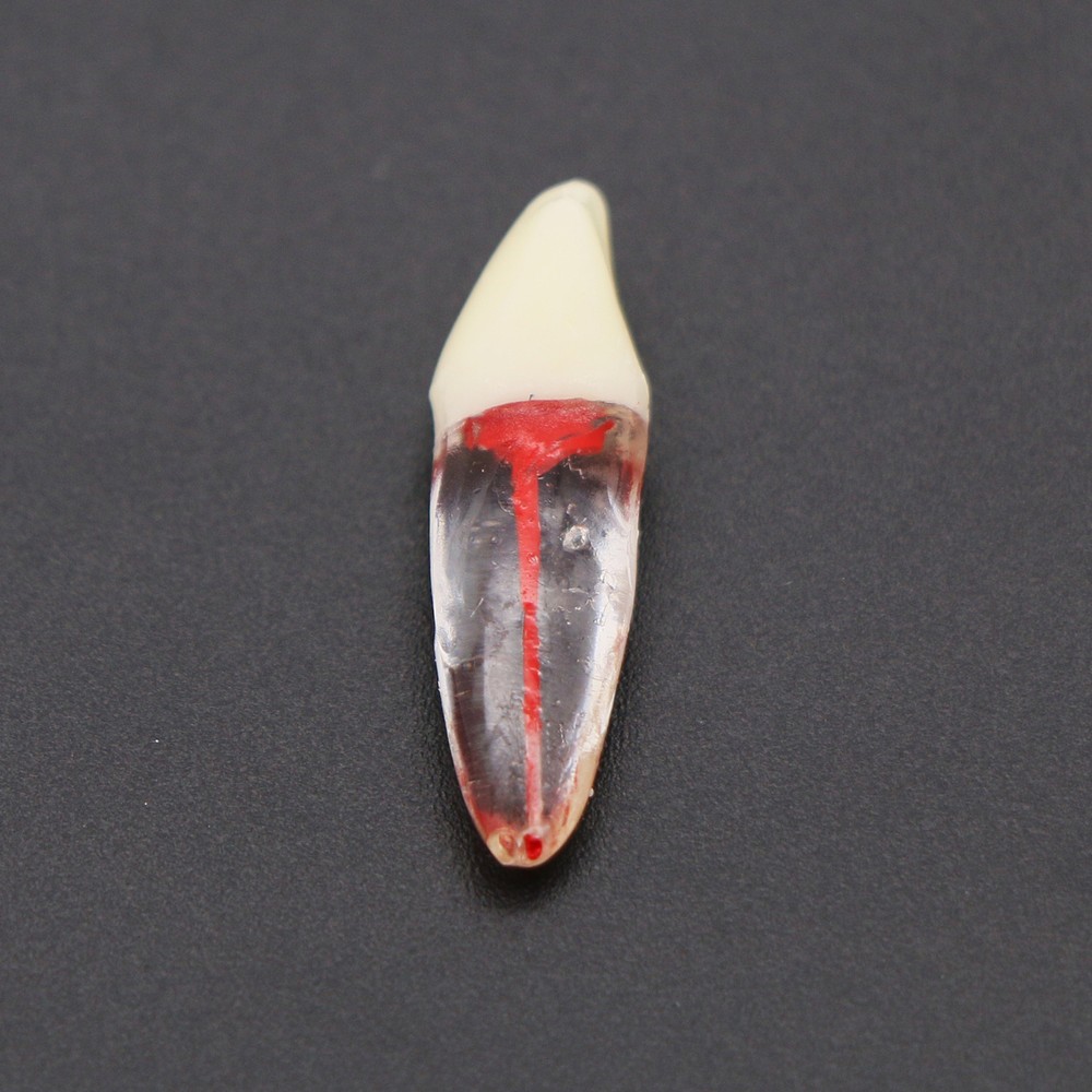 Dental Root Canal RCT Block Pulp Cavity Practice Model for Endo File Study Teeth