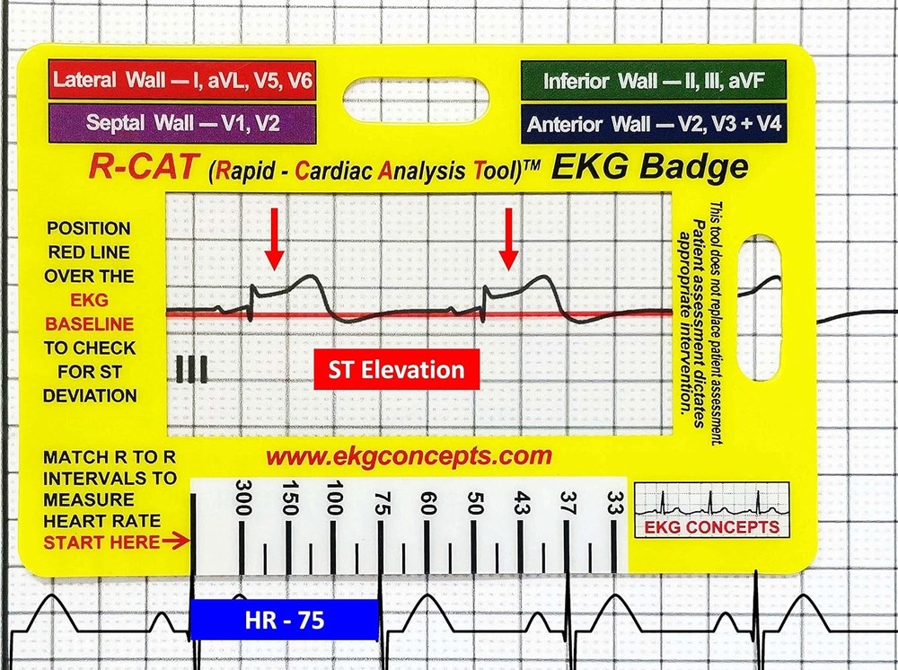 EKG Badge