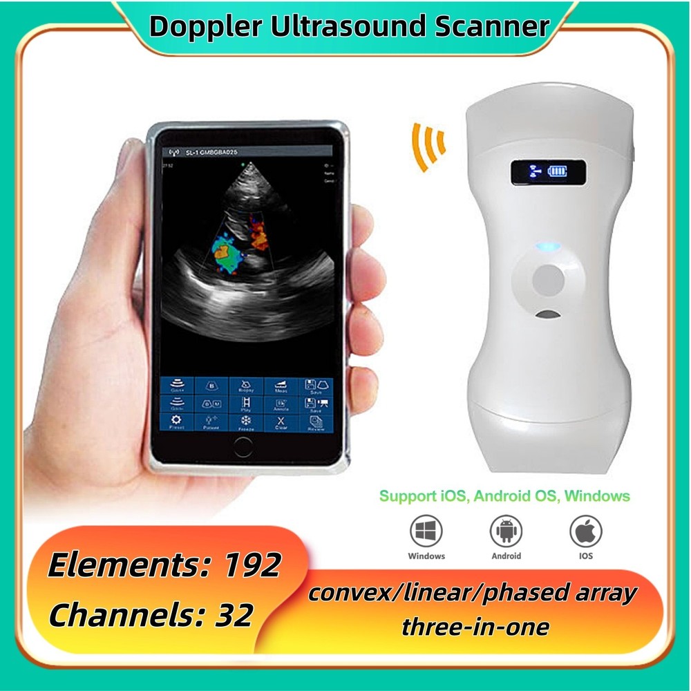 192 Elements  convex/linear/phased array 3 in 1 Doppler Ultrasound Scanner
