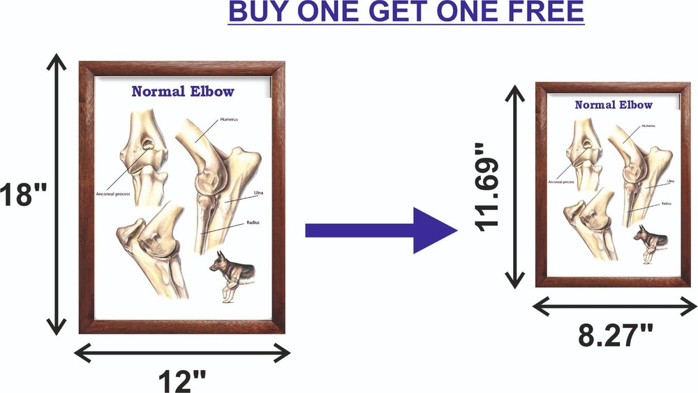 Normal Elbow Chart 12x18 inches