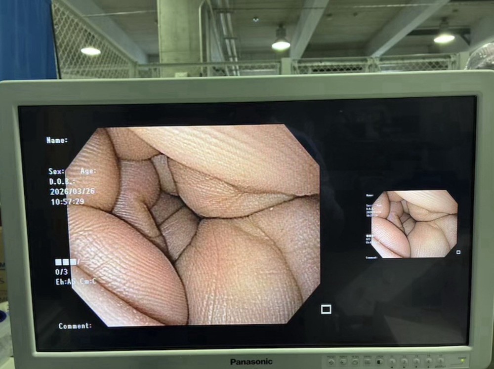 Endoscope system CV-190 / CLV-190PLUS OLYMPUS