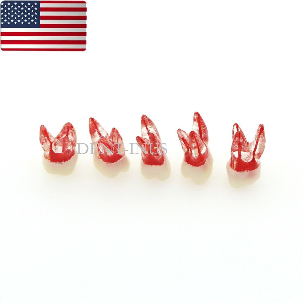 US Dental Endo Molar Root Canal Study Practice Block Pulp Cavity Model RCT/MTA