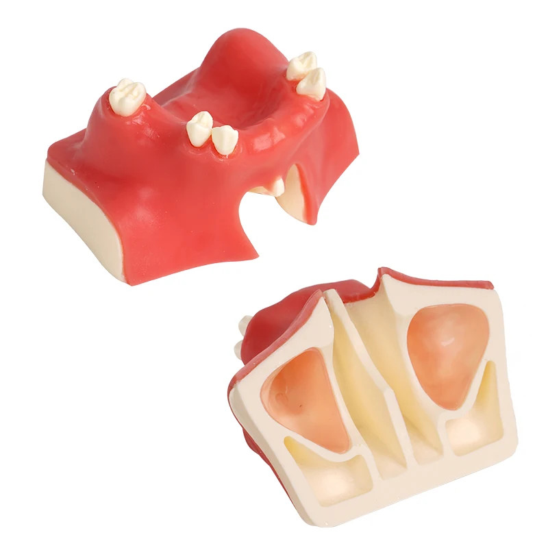 1pc Maxillary Sinus Teeth Model Dental Student Teaching Practice Model Upper Jaw