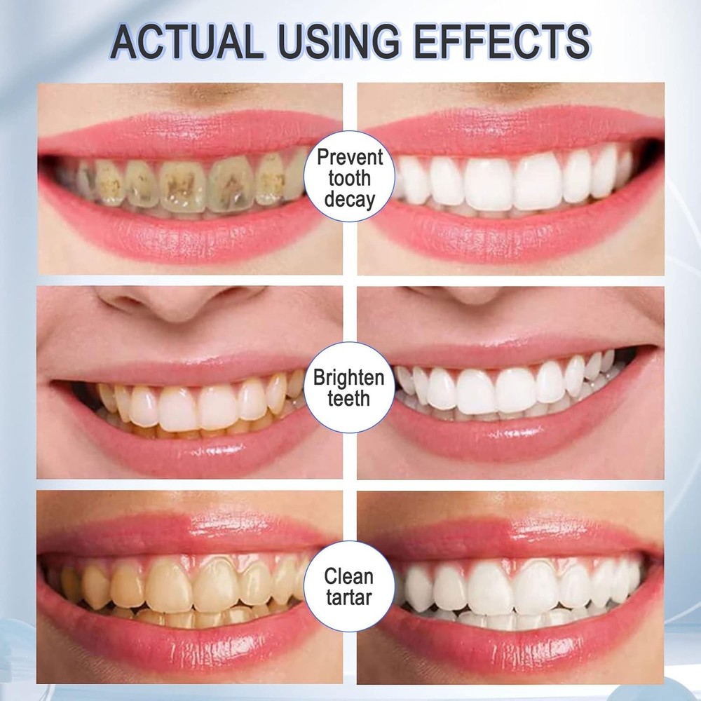 Teeth Whitening Toothpaste, Mousse Foam Toothpaste, 2 Pack Foam Toothpaste for U