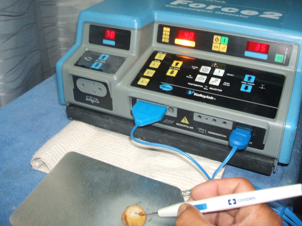 Valleylab Force 2 ESU, Pt. Ready, Nice/Clean/In Great Working Condition, Cert'd