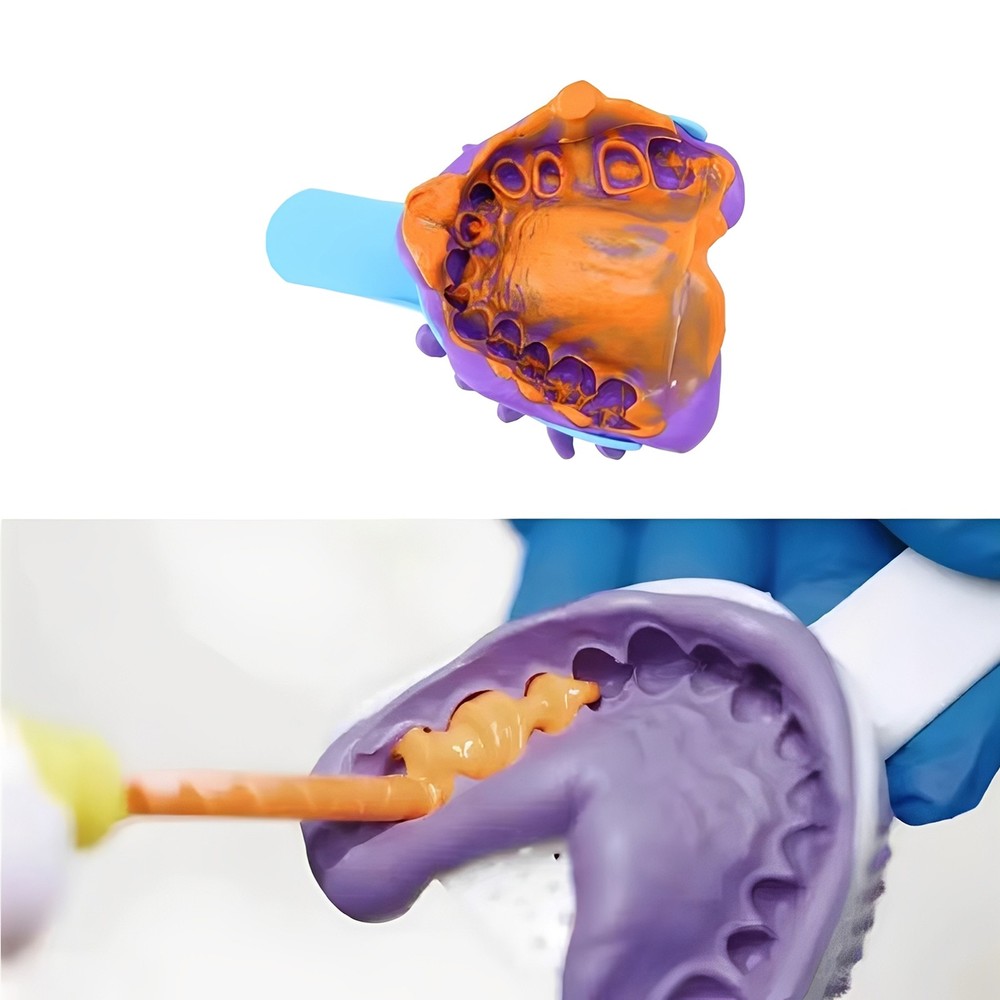 Light Body Regular Set – Cartridges & 5 Tips (Dental Impression Material)