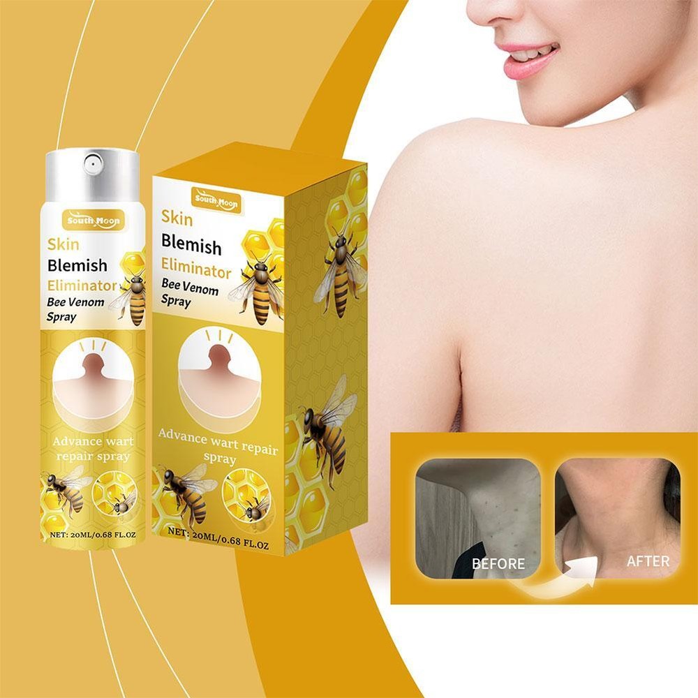 Tag Recede Bee Spray, Bee Warts and Button Removal Treatment/ ☆☆US