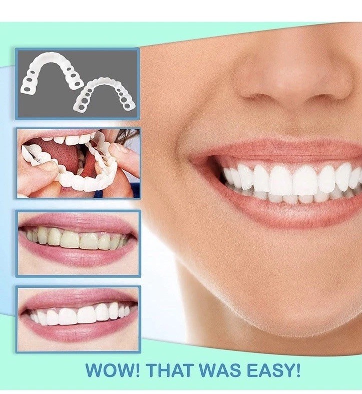 Sotiras Smile Veneers
