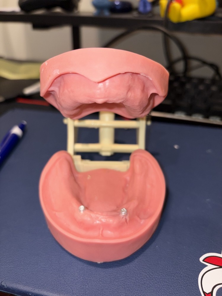 Frasaco Edentulous Dentoform with Lower Implants