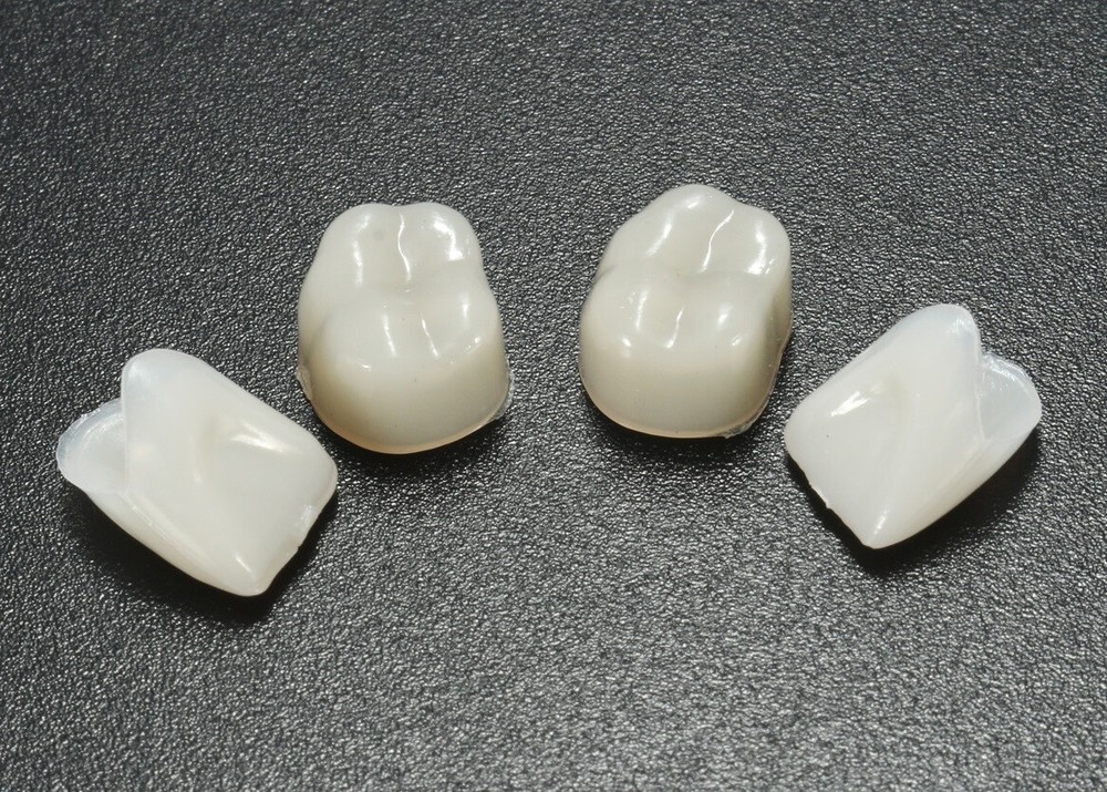 60pcs Dental Temporary Crown Veneers Material Anterior Front Molar Teeth Plastic
